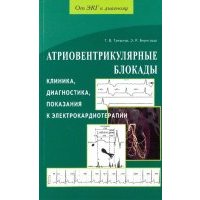 Атриовентрикулярные блокады. Клиника, диагностика, показания к электрокардиотерапии 