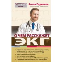 О чем расскажет ЭКГ 