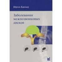 Заболевания межпозвонковых дисков 