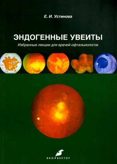 Книга: Эко-Вектор Эндогенные увеиты. Избранные лекции для врачей-офтальмологов 978-5-906648-24-2
