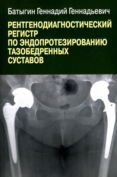 Книга: Высшее образование и наука Рентгенологический регистр по эндопротезированию тазобедренных суставов 978-5-94084-048-0