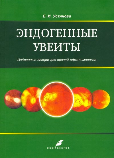 Книга: Эко-Вектор Эндогенные уевиты. Избранные лекции для врачей-офтальмологов 978-5-907201-04-0